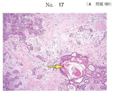 Η-E染色病理組織像(別冊No.17)