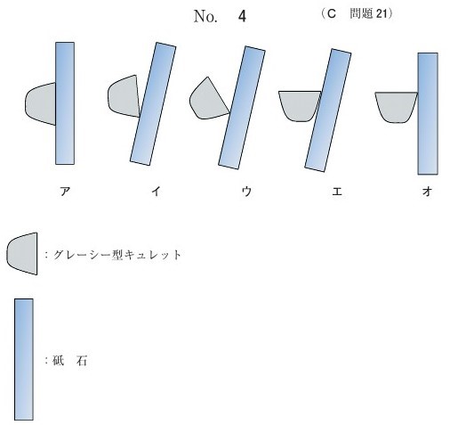グレーシー型キュレットと砥石の模式図(別冊No.4)